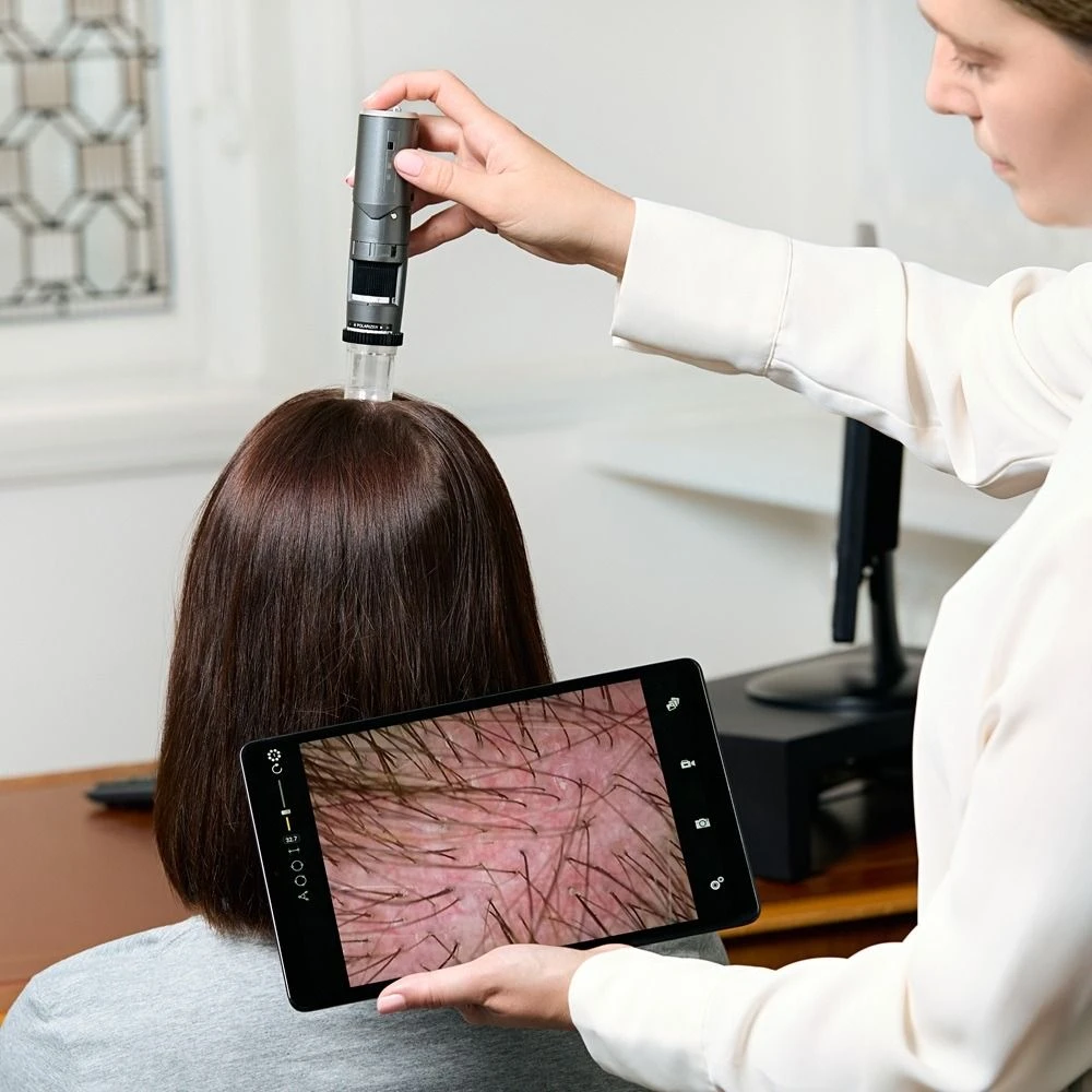Scalp Test